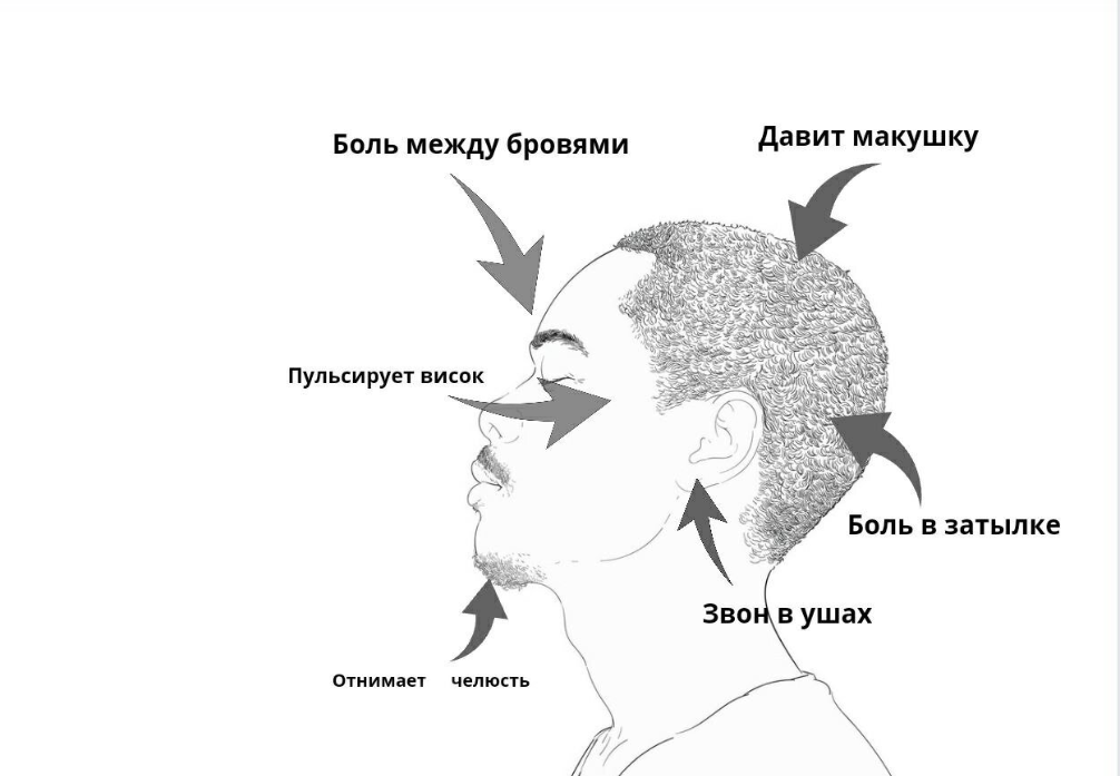 Виды головной боли и их причины: не потеряйте эту шпаргалку