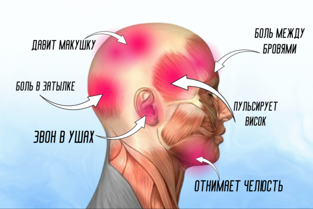 О чем говорит боль в разных частях головы